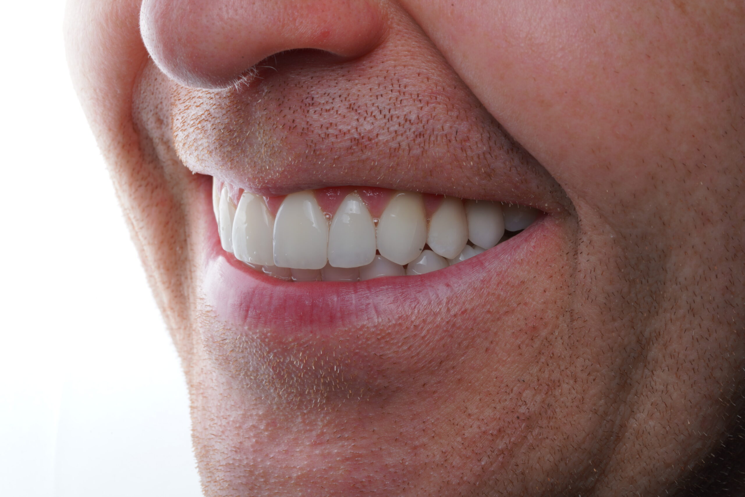 Close-up of a dental checkup showing tools and patient's mouth with a blurred background.