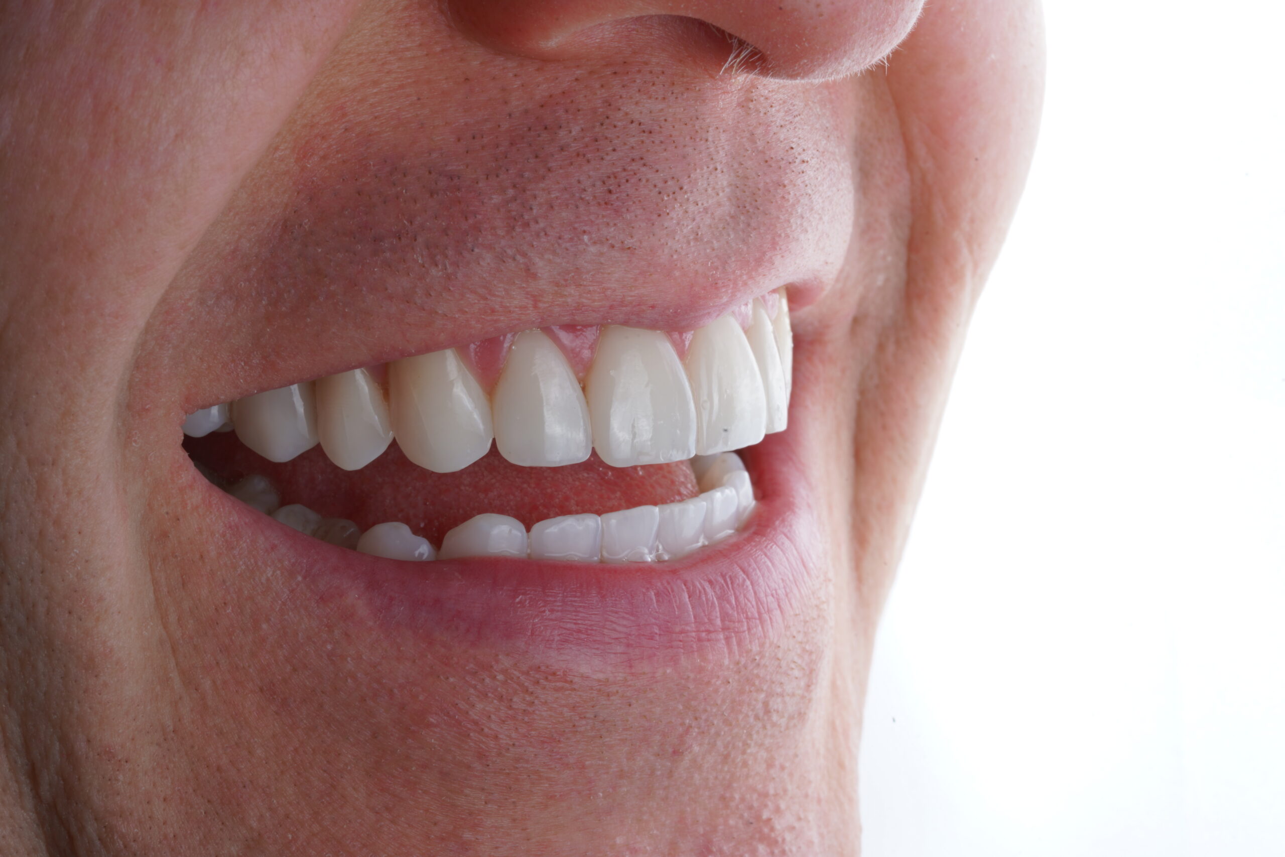 Close-up of a dental checkup showing tools and patient's mouth with a blurred background.