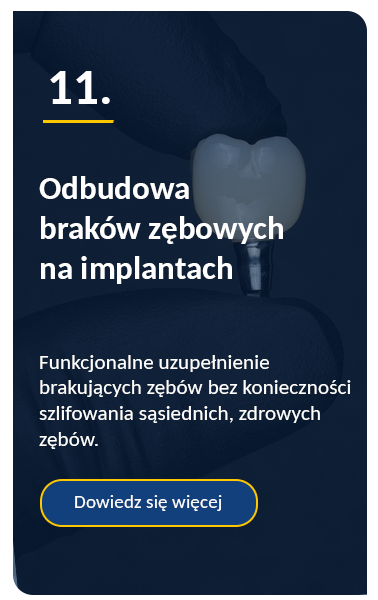 Odbudowa braków zębowych na implantach
