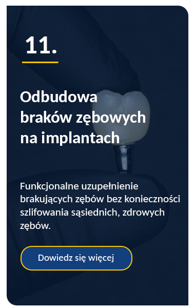 Odbudowa braków zębowych na implantach