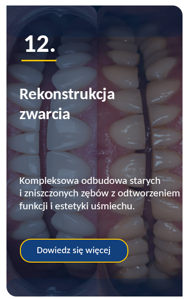 FMR -kompleksowa rekonstrukcja zwarcia
