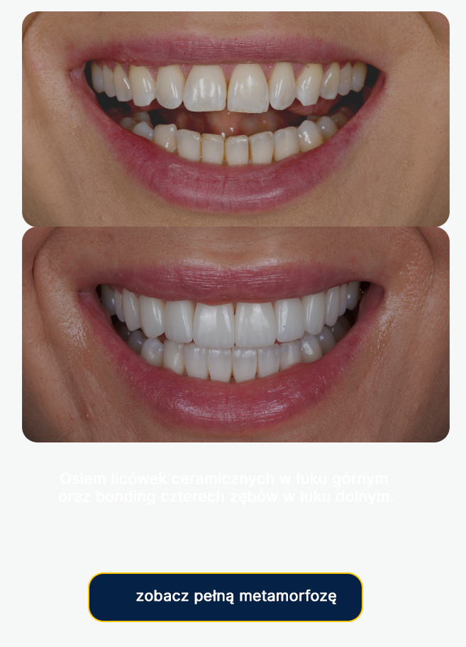 porcelanowe