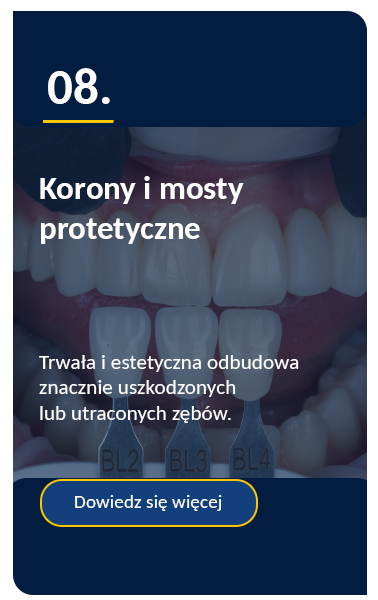 korony i mosty protetyczne